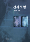 간세포암 표지 이미지