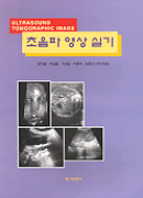 초음파 영상 실기 = Ultrasound tomographic image