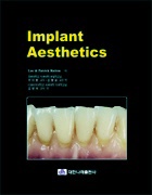 Implant aesthetics