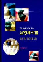 (고정성보철기공을 위한)납형제작법