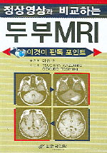 (정상영상과 비교하는)두부MRI : 이것이 판독 포인트