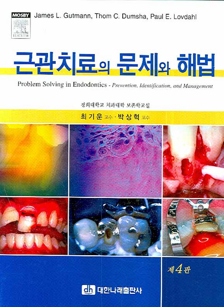 근관치료의 문제와 해법