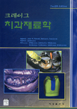 (크레이그)치과재료학