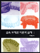 금속 도재관 이론과 실제. 1