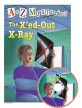 The X´ed-Out X-Ray (A to Z Mysteries #X)
