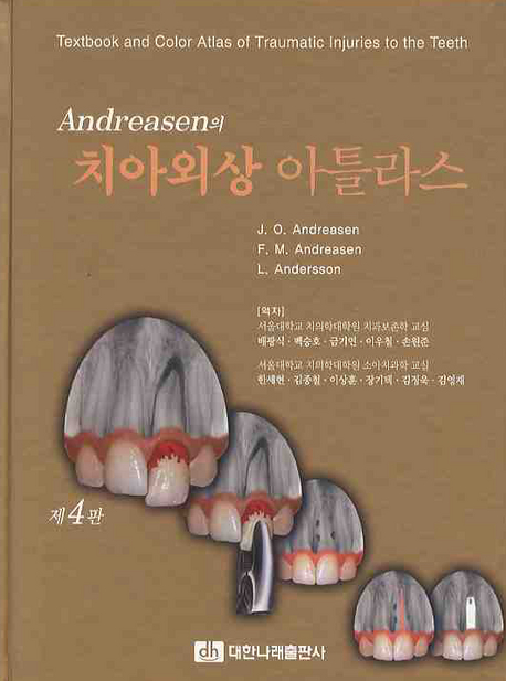(Andreasen의)치아외상 아틀라스