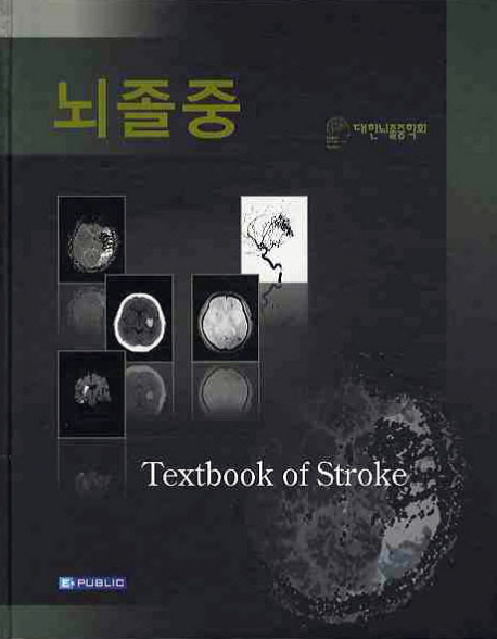 뇌졸증