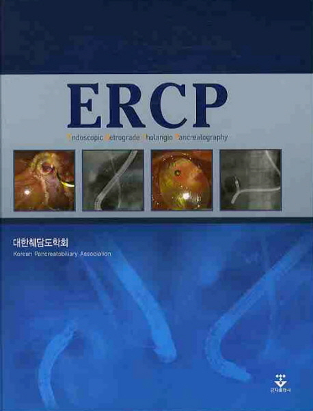 ERCP