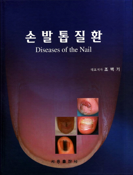 손발톱질환  = Diseases of the nail