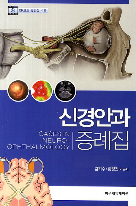 신경안과 증례집 = Cases in neuro-ophthalmology