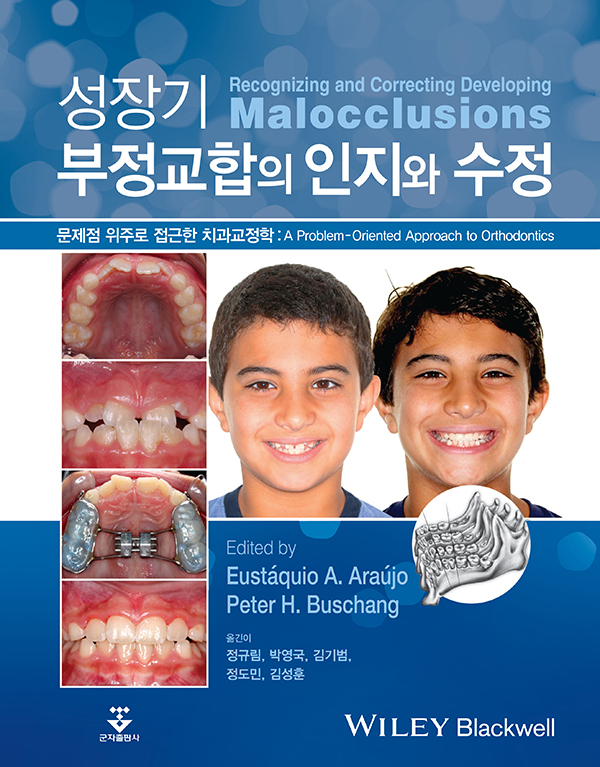 성장기 부정교합의 인지와 수정 : 문제점 위주로 접근한 치과교정학
