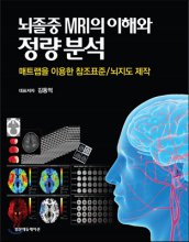 뇌졸중 MRI의 이해와 정량분석 : 매트랩을 이용한 참조표준 / 뇌지도 제작
