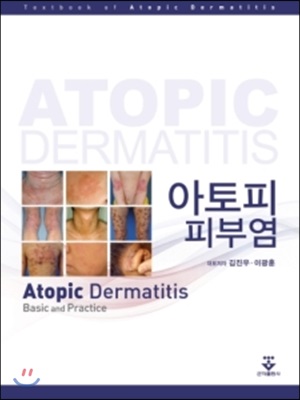 아토피피부염 : basic and practice  = Atopic dermatitis