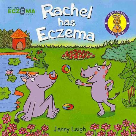 Rachel has eczema