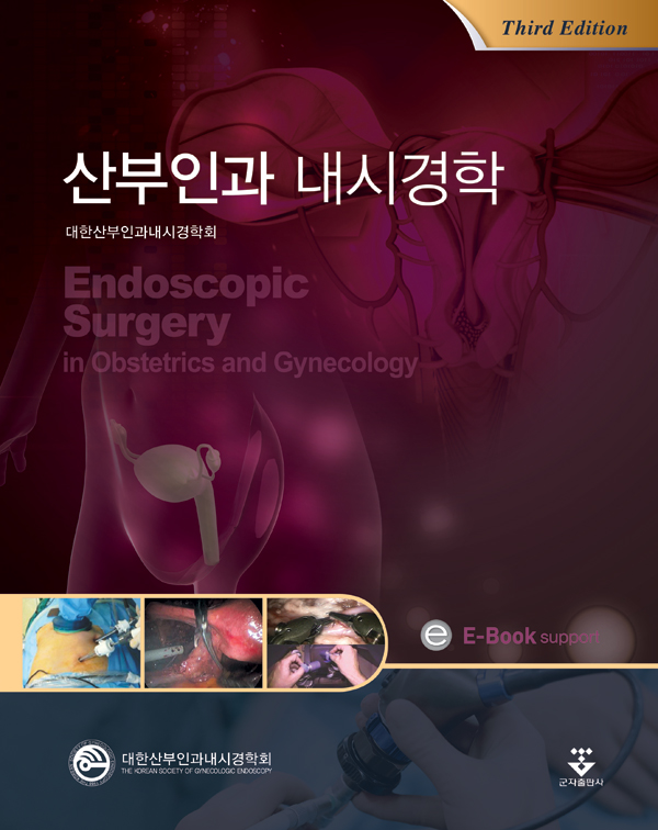 산부인과 내시경학 = Endoscopic surgery in obstetrics and gynecology