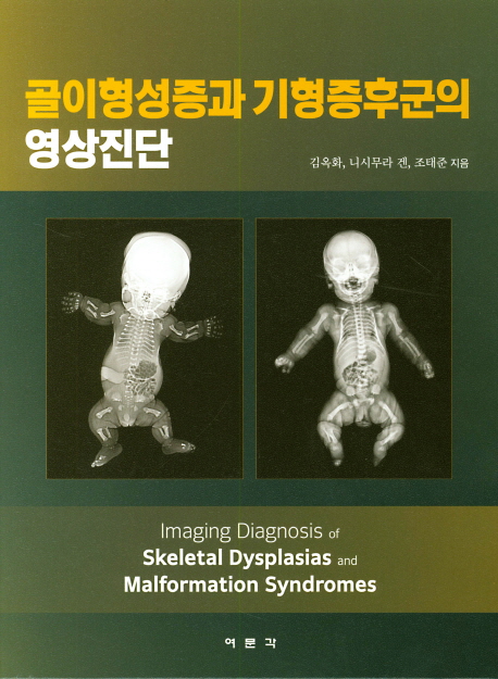 골이형성증과 기형증후군의 영상진단  = Imaging diagnosis of skeletal dysplasias and malformation syndromes