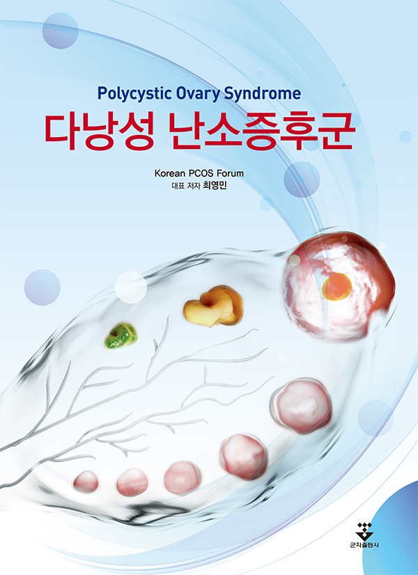 다낭성 난소증후군 = Polycystic ovary syndrome / 지은이: 최영민 외 Korean PCOS Forum ; 집필...